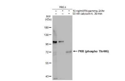 Western Blot: PKR [p Thr446] Antibody [NBP3-13141]